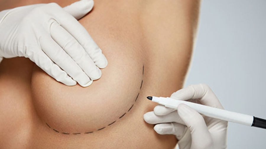 how much does it cost for breast enlargement, breast enlargement injections in south africa, breast augmentation cape town, breast enlargement pills at clicks, best breast augmentation surgeon in south africa, breast implants side effects, breast surgery, breast augmentation surgery johannesburg,